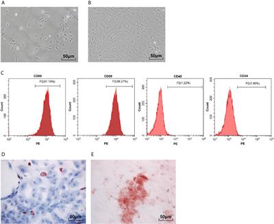 Bone Marrow-Derived Mesenchymal Stem Cells Ameliorate Sepsis-Induced Acute Kidney Injury by Promoting Mitophagy of Renal Tubular Epithelial Cells via the SIRT1/Parkin Axis